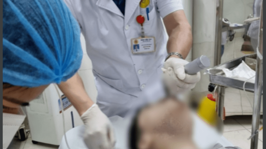 Khoa cấp cứu, Bệnh viện 19-8 cứu sống một trường hợp bị hóc tràng lợn dẫn tới nghẽn đường thở