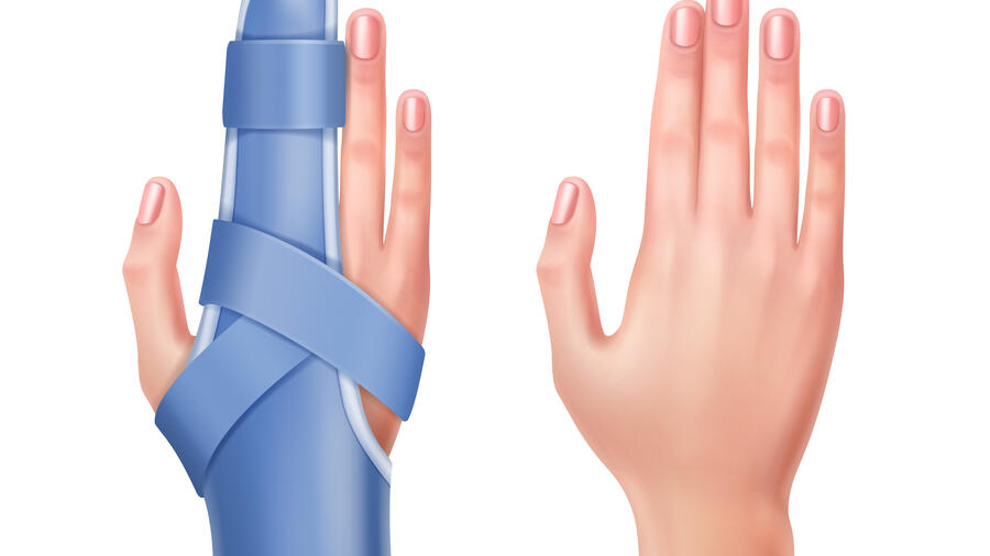 QUY TRÌNH KỸ THUẬT PHẪU THUẬT TÁCH DÍNH 2 NGÓN TAY