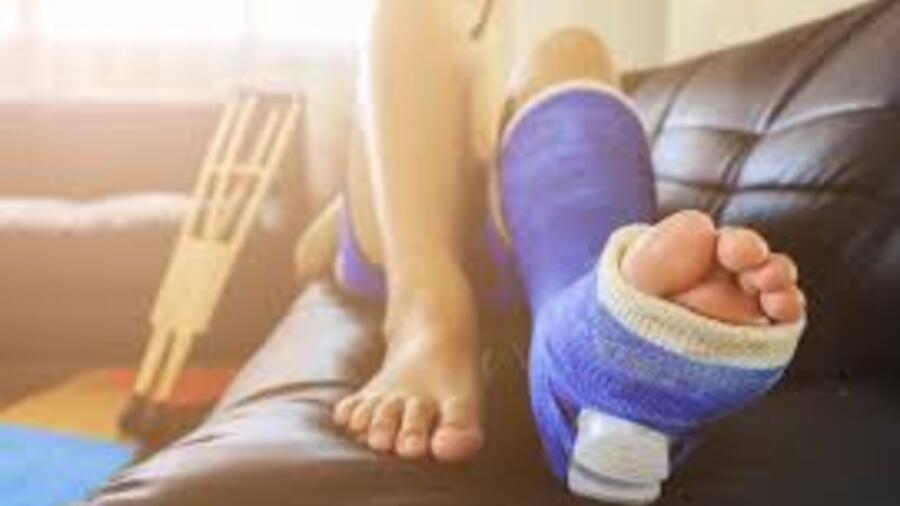 QUY TRÌNH KỸ THUẬT BÓ BỘT ĐIỀU TRỊ BẢO TỒN GẪY XƯƠNG GÓT