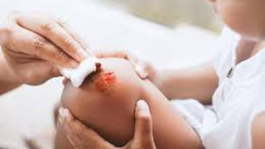 QUY TRÌNH KỸ THUẬT SƠ CẤP CỨU VÀ CHĂM SÓC VẾT THƯƠNG PHẦN MỀM