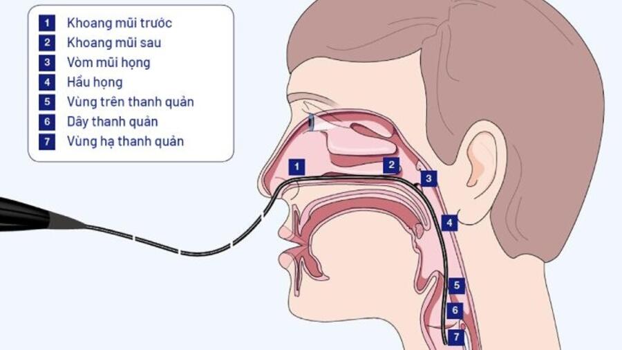 NỘI SOI HẠ HỌNG-THANH QUẢN ỐNG CỨNG/ MỀM SINH THIẾT