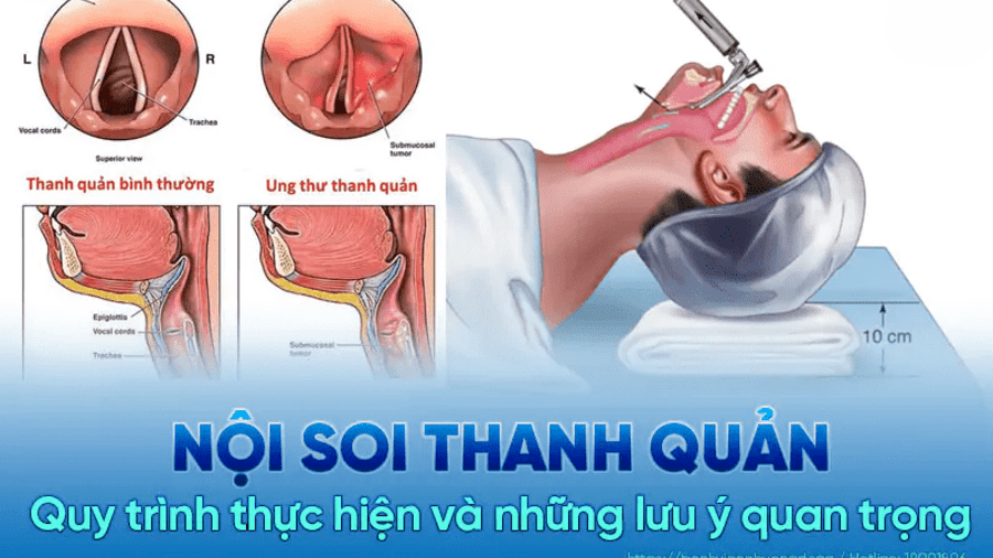NỘI SOI THANH QUẢN LẤY DỊ VẬT