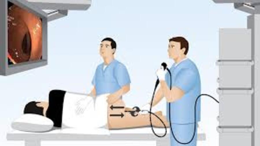NỘI SOI THANH QUẢN ỐNG MỀM CHẨN ĐOÁN/ SINH THIẾT