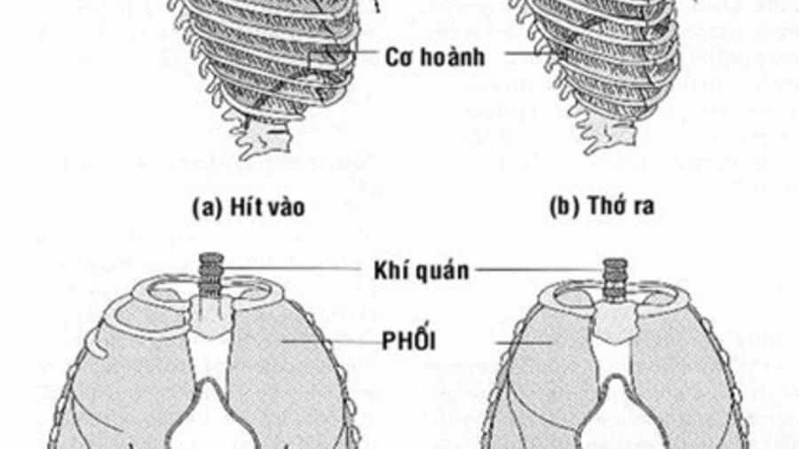 PHẪU THUẬT THÀNH CÔNG BỆNH NHÂN NHÃO CƠ HOÀNH